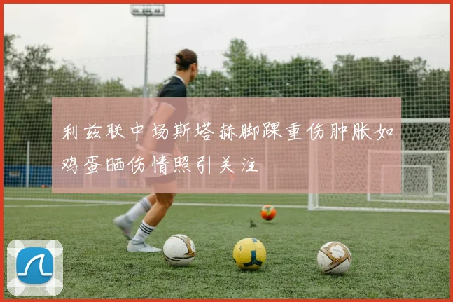 利兹联中场斯塔赫脚踝重伤肿胀如鸡蛋晒伤情照引关注